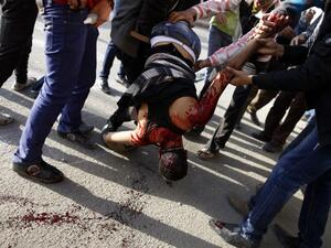 Egyptian protesters carry their gravely injured comrade during clashes with riot police near Tahrir Square in Cairo on March 9, 2013. Two protesters were killed in the clashes in Cairo --one from bird shot and one from suffocation. (AFP PHOTO / MAHMOUD KHALED)