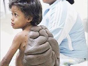 الطفل السلجفاة وامه