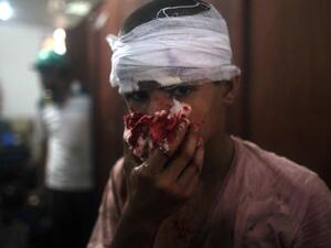 An injured Egyptian youth is seen at a makeshift hospital during clashes between supporters of Egypt's ousted president Mohamed Morsi and police in Cairo on Wednesday. (AFP)