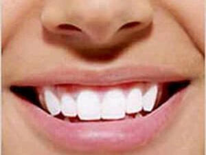 فم حلو.. ونضيف