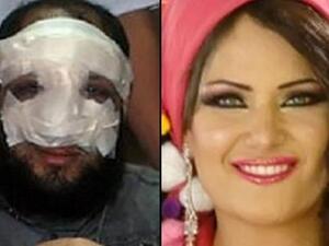 Sama and her alleged husband: the Salafi MP with a nose job