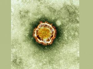An electron image of the nCoV virus. 