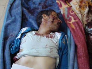 A  man who was allegedly killed in mortar attacks at Camp Liberty, an exile camp housing Iranian dissidents near the Iraqi capital Baghdad, on February 9. Assailants fired dozens of mortars and rockets at the camp in a dawn attack that killed five people, the first deaths from violence since they resettled near Baghdad last year. (AFP Photo/HO/Mujahedeen-e-Khalq)