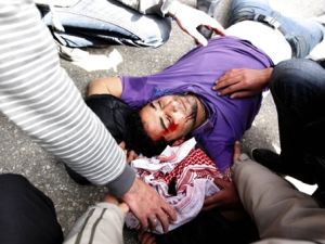 مصاب في مظاهرات الداخلية- ارشيف