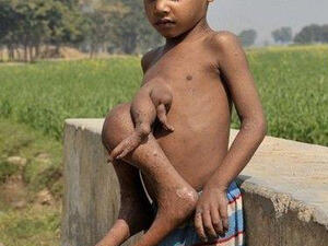 يستند الى السور وتؤأمه يتدلى من بطنه