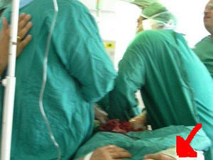 في غرفة العمليات اثناء اجراء عملية لراجل