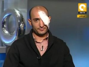Reports state that the military have been ordered 'to shoot to blind': a policy that might explain the excessive number of eye injuries coming out of this tragic Tahrir saga. 
