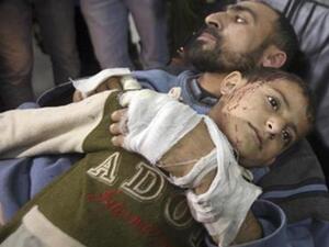 فلسطيني وابنه أصيبا في غارة اسرائيلية على قطاع غزة يوم الاثنين
