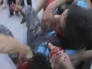 مصاب خلال احتجاج في حمص
