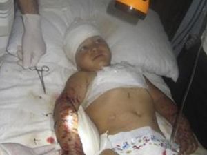 صورة أرشيفية لطفل أصيب في قصف يتلقى العلاج في مستشفى متنقل بالحولة قرب حمص