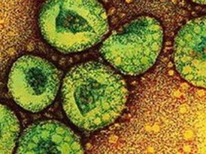 A total of 28 people have been killed from the SARS coronavirus in Saudi Arabia, the health ministry said recently. Meanwhile, countries such as Jordan, France, the United Arab Emirates, Germany as well as Britain and Tunisia have reported infections of the MERS-CoV strain. 