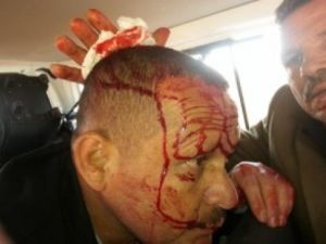 اصابة خمسة اردنيين مؤيدين للنظام السوري في هجوم على حافلتهم في سوريا
