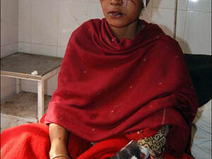 المرأة التي هاجمها النمر