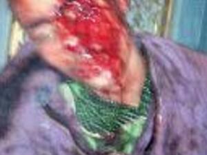 'Victim of torture at presidential palace' (Photo: Mohamed El-Garhi)