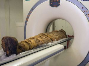 Researchers have found that long before the Western diet of red meat, fat and salt, ancient hunter-gatherers also suffered from clogged arteries.