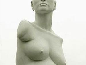 Phocomelia a rare medical condition where from birth the patient has no limbs. This marble statue is of the courageous now famous Alison Lapper, mother and active member of society born with the condition.