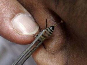 اللسع بالنحل