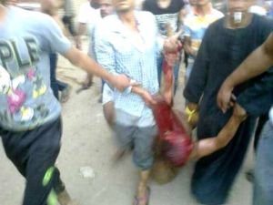 صورة نشرتها مواقع اخبارية مصرية لما تقول انها احد الشيعة الذين تم قتلهم وسجلهم على يد القرويين في الجيزة