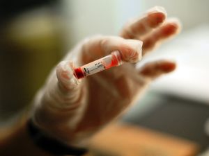 Thalassaemia is prevalent in the Middle East and often exists in your family: It's worth finding out if you're a carrier of this genetic condition before marriage by earlier detection blood tests.