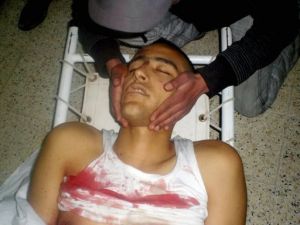 احد ضحايا الاحتجاجات في تونس