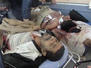 رجلان يتلقيان العلاج في مستشفى بعد اصابتهما في مواجهة بين قوات الامن ومحتجين سنة في كركوك
