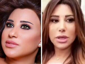 نجوى كرم تكشف عن السبب الحقيقي لتجميل أنفها