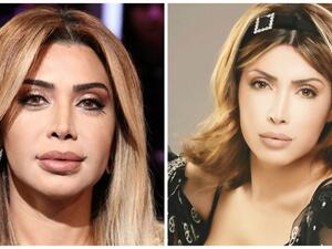 Do you like her plastic fantastic face? (Hia Mag)