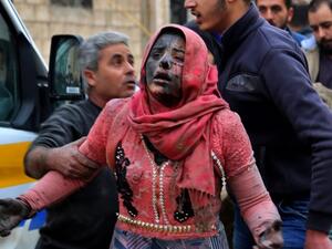 امرأة جريحة مغطاة بالغبار بعد قصف نفذه النظام السوري، الجمعة، على بلدة خان شيخون في محافظة إدلب

