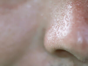 تجتمع الأوساخ الناتجة عن إفرازات الجلد  والمكياج يراكم الدهون على الأنف