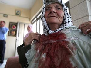 A Palestinian woman displays her dress, stained with blood after Israeli settlers attacked her with a stone while she was harvesting olives on October 31, 2011.  (AFP/Abbas Momani)