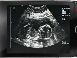 "Baby Ultra Sound MMS” service