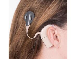 القوقعة هي عبارة عن جهاز إلكتروني يتيح للمرضى الذين لم يستجيبوا بالكامل لمعينات السمع سماع الأصوات.