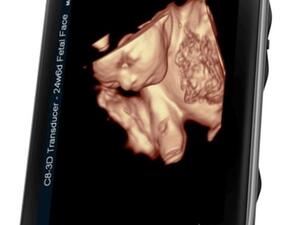 خدمة "موبايل بيبي"