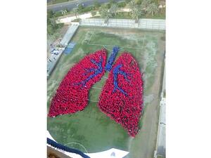 أكبر رئة بشرية في العالم