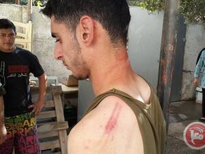 صورة الفتى الذي تعرض للاعتداء
