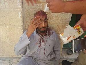 أحد المعتكفين ينزف بعد اعتداء قوات الاحتلال عليه 