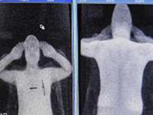 هكذا يظهر الجسد في الجهاز الجديد