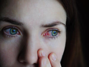 يجب تنظيف الإفرازات التي توجد في العين حتى لا تحدث اضطرابات في الرؤية (shutterstock.com)