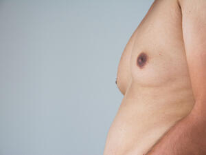 بالرغم من أن هذه المشكلة ليست خطيرة، إلا أنها تشكل الإحراج لدى الرجال (shutterstock.com)
 بالرغم من أن هذه المشكلة ليست خطيرة، إلا أنها تشكل الإحراج لدى الرجال (shutterstock.com)