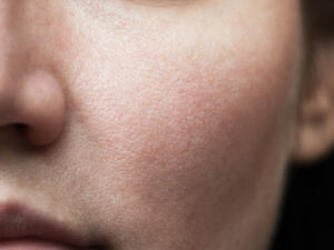 يتم تحضير هذه الوصفة خلال دقائق  (shutterstock.com)
