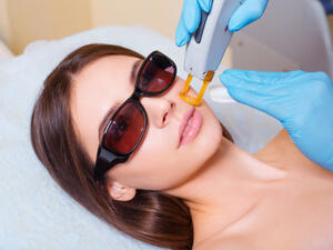 بات بالإمكان معالجة مشاكل البشرة في جلسة ليزر واحدة لا تتعدى مدتها الساعة (shutterstock.com)