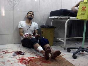 مديرية صحة حلب تعلن توقف جميع مشافي المدينة عن العمل