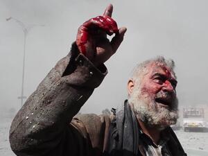 أحد العراقيين المصابين جرّاء القصف الأمريكي على منطقة المجموعة الثقافية في الموصل - يوتيوب