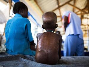 14 مليون شخص يواجهون خطر الجوع في دول جنوب أفريقيا