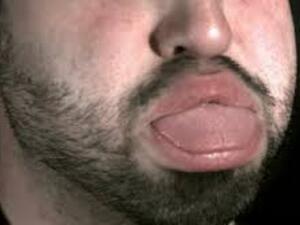 Sneaky spitters have been stopped! (Shutterstock)