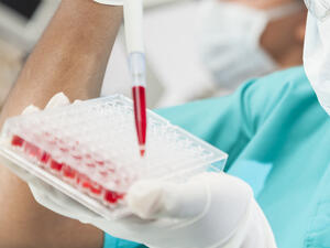 The Saudi Ministry of Health will not test female students for AIDS.