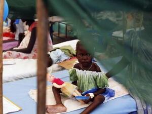 طفلة تعاني من سوء التغذية في معسكر أقامته منظمة أطباء بلا حدود في ملكال
