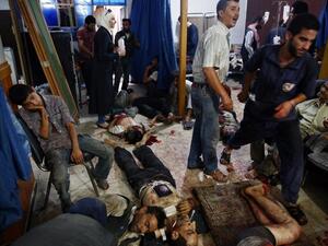 Injured people receive treatment at a make-shift hospital in the rebel-held area of Douma, east of the capital Damascus, following airstrikes by Syrian government forces on a marketplace on August 16, 2015. (AFP/Abd Doumany)