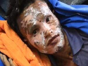 كشفت التقارير الطبية عن استقبال حالات عليها اعراض غريبة نتيجة الأسلحة المحظورة

