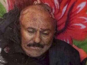  الرئيس اليمني السابق علي عبدالله صالح 